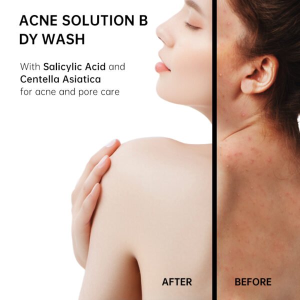 NIULOO Factory Customized English Pear & Freesia Body Wash Scented Shower Lotion For Back Acne Manufacturer OEM Private Label - Image 3