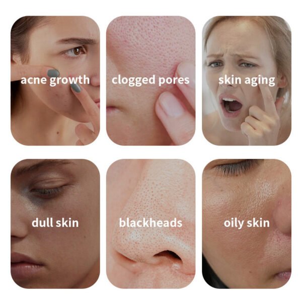 NIULOO Factory Customized Amazon TikTok Hot Selling Skin Care Spreadable Clay Mask Improve Stain Cleansing Mud Mask Manufacturer Wholesale OEM Private Label - Image 4